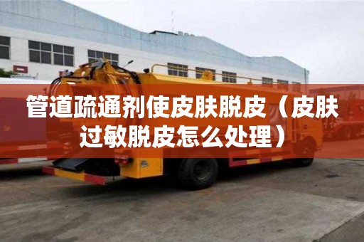 管道疏通劑使皮膚脫皮（皮膚過(guò)敏脫皮怎么處理）